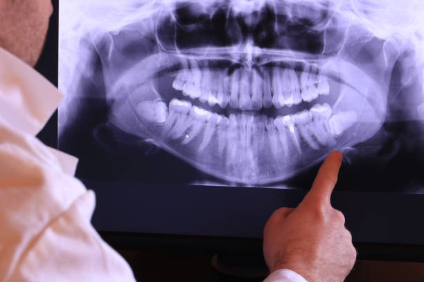 Best Emergency Root Canal Treatment in Wesley Chapel, NC