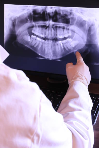 Best Emergency Treatment for Toothache in Wesley Chapel, NC