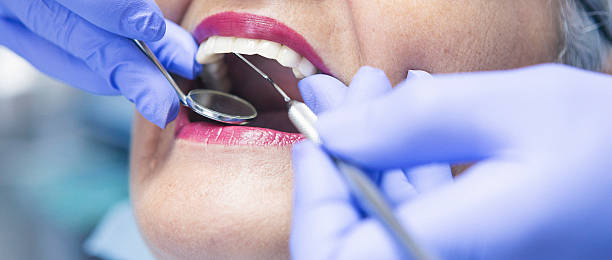 Best Emergency Treatment for Toothache in Wesley Chapel, NC